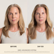 GRO+ Avancé — Après-shampooing Équilibrant & Réparateur