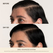 GRO+ Advanced — Dermaroller Stimulant