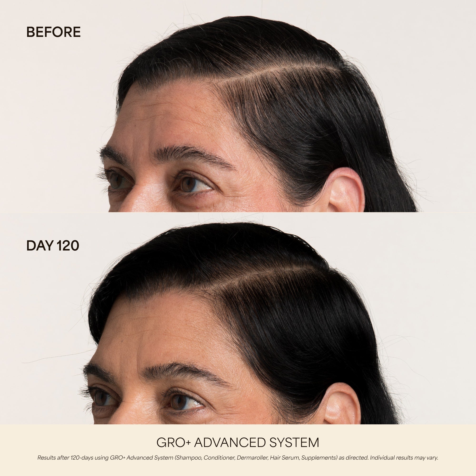 GRO+ Advanced — Sérum Croissance & Densité