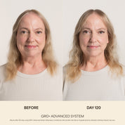 GRO+ Avancé — Après-shampooing Équilibrant & Réparateur