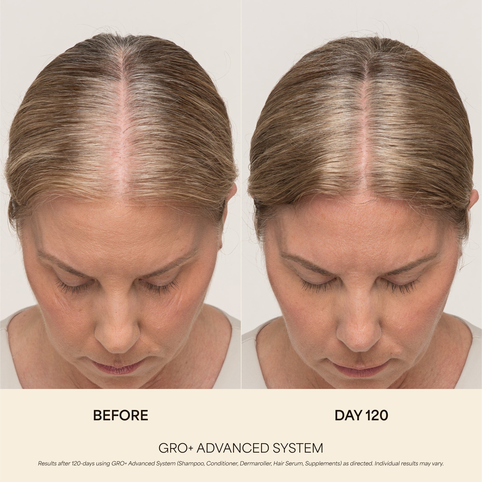 GRO+ Advanced — Dermaroller Stimulant