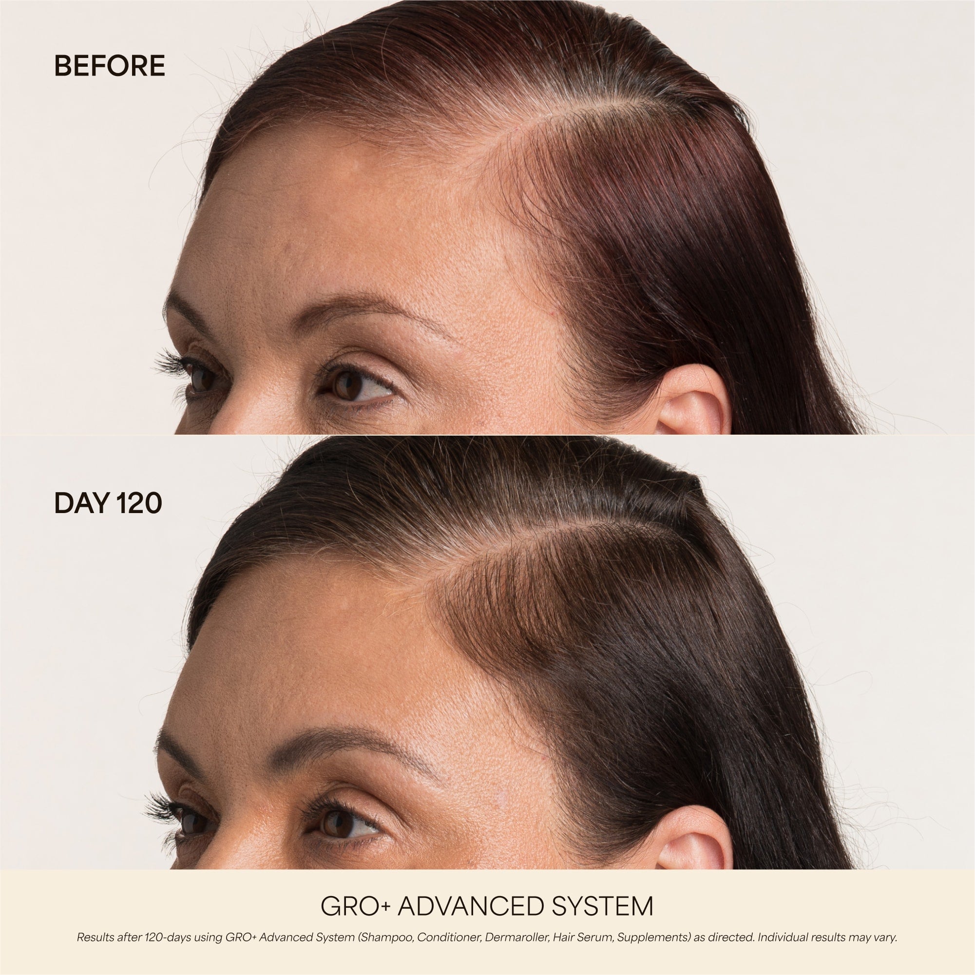 GRO+ Advanced — Dermaroller Stimulant
